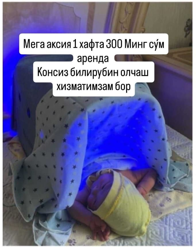 Fotolampa fototerapiya ot jeltuxi v arendu na dom